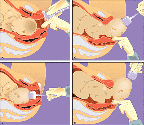 Kolkata Best Gynaecologist Doctor
