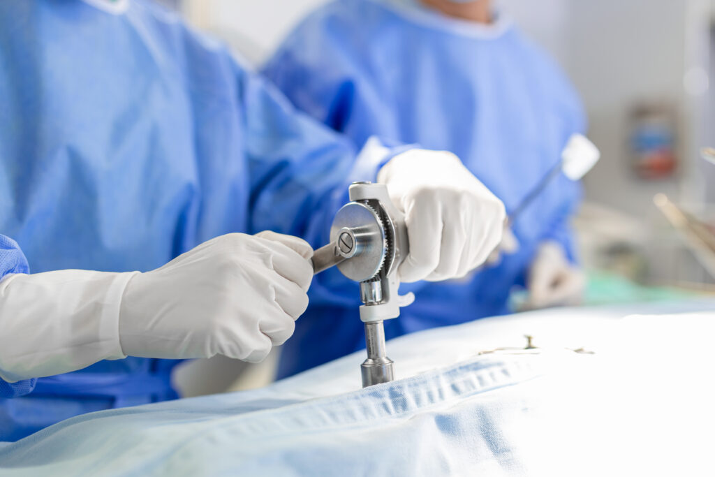 Minimally Invasive Gynaecology in Kolkata - A Modern Approach to Womens Health 1 Minimally Invasive Gynaecology in Kolkata